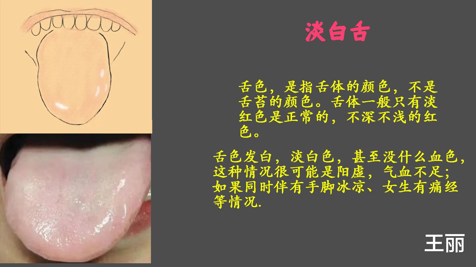 |中医：小小舌头，大有乾坤；认识几种常见的经典舌头，带详细图解