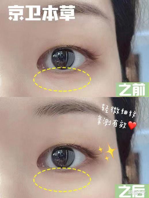 眼霜 几十块的老国货虽然有点丑，但效果韩国欧巴都忍不住夸：杠杠的！