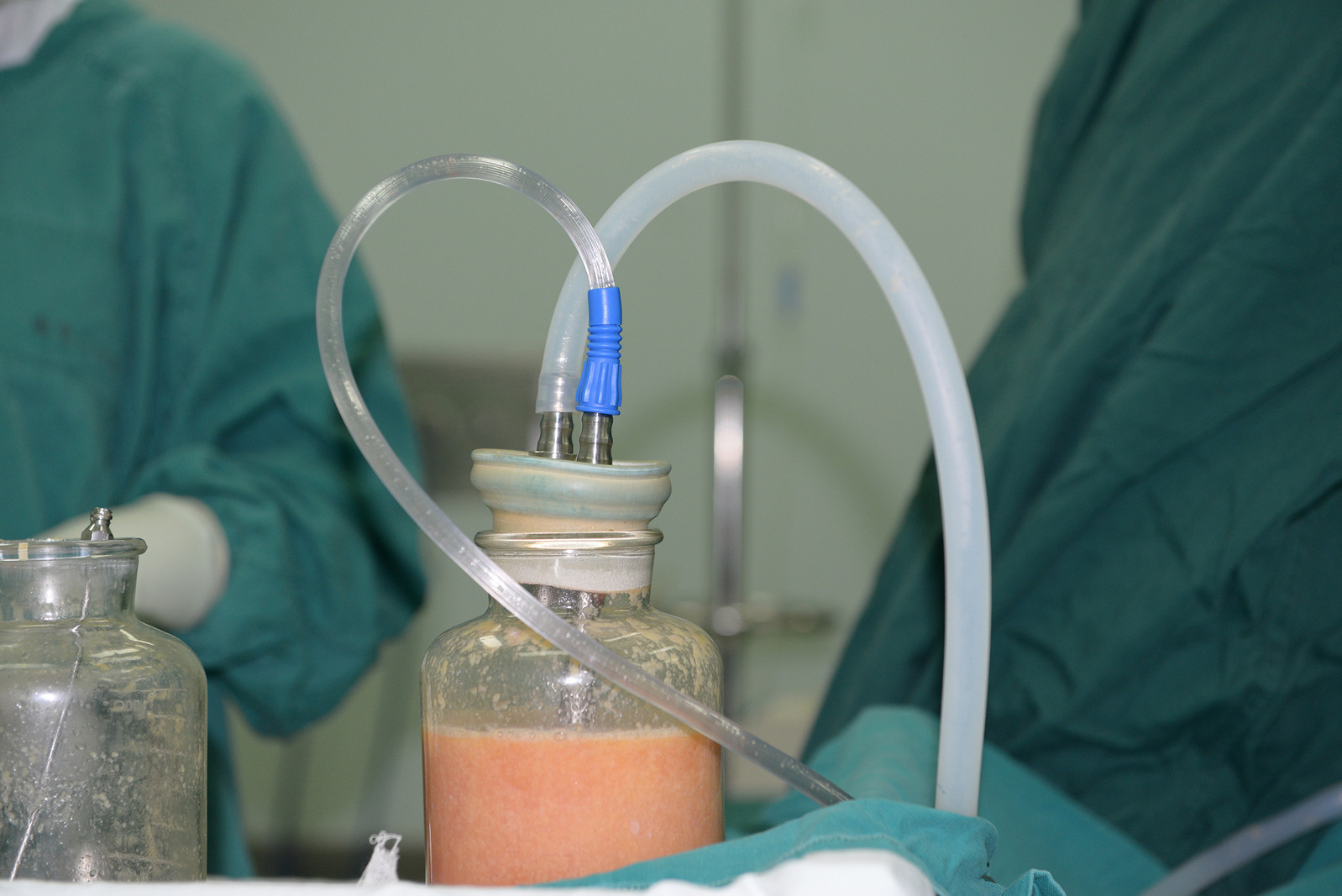 抽脂|104斤女子花费7万元抽脂，抽完大腿凹凸不平上厕所都蹲不了