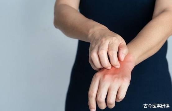 古今医案研读|身体瘙痒，挠一挠就没事了，医生：可能是这三种大病！