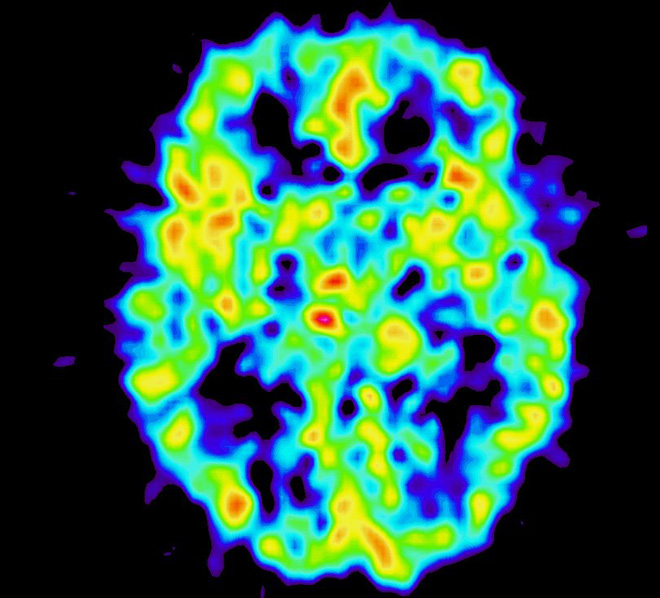 鲸头鹳 鲸鱼一天只睡7分钟，而为什么大多数鱼一辈子都不用睡觉？