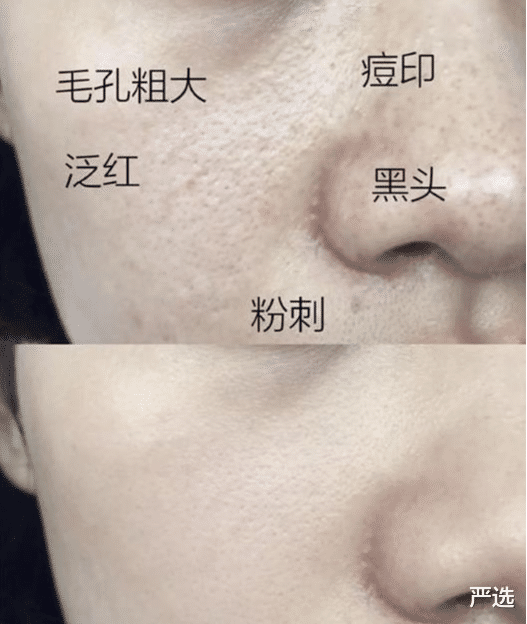 杨超越|俞飞鸿49岁的素颜照，皮肤白嫩毫无槽点，一点也没老年脸的松垮感