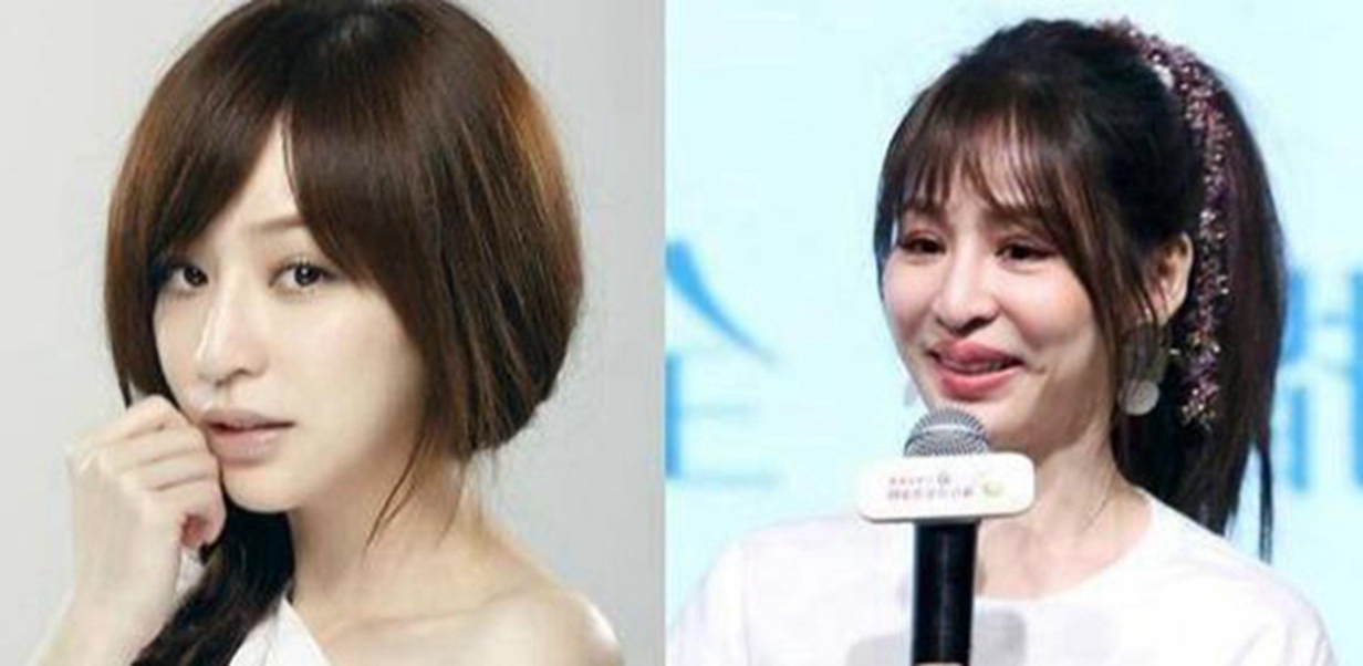 王心凌|这些女星的玻尿酸脸“崩塌了”，王心凌面目全非，张檬成塑料脸