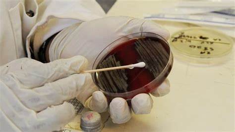 医生|4种药物很便宜,医生家中常备,但是药店从来不主动推荐