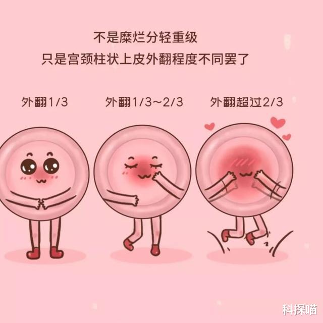 体检|体检时查出这4种病，或无需过度治疗，不要自己吓唬自己！