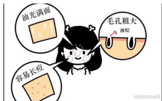 发型 “毛孔粗大”怎么办？确定类型、对症解决，才能有效收缩毛孔！