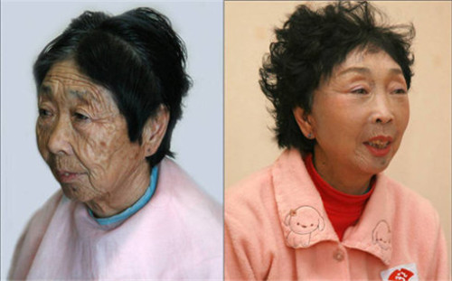 李玉成|23年前，那位整容后坚持嫁给28岁外甥的60岁老太太，如今过得怎样