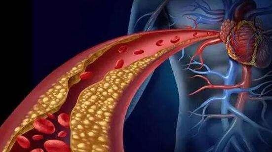 医生|62岁大叔两天吃一次降脂药,后来身体如何?医生揭晓答案