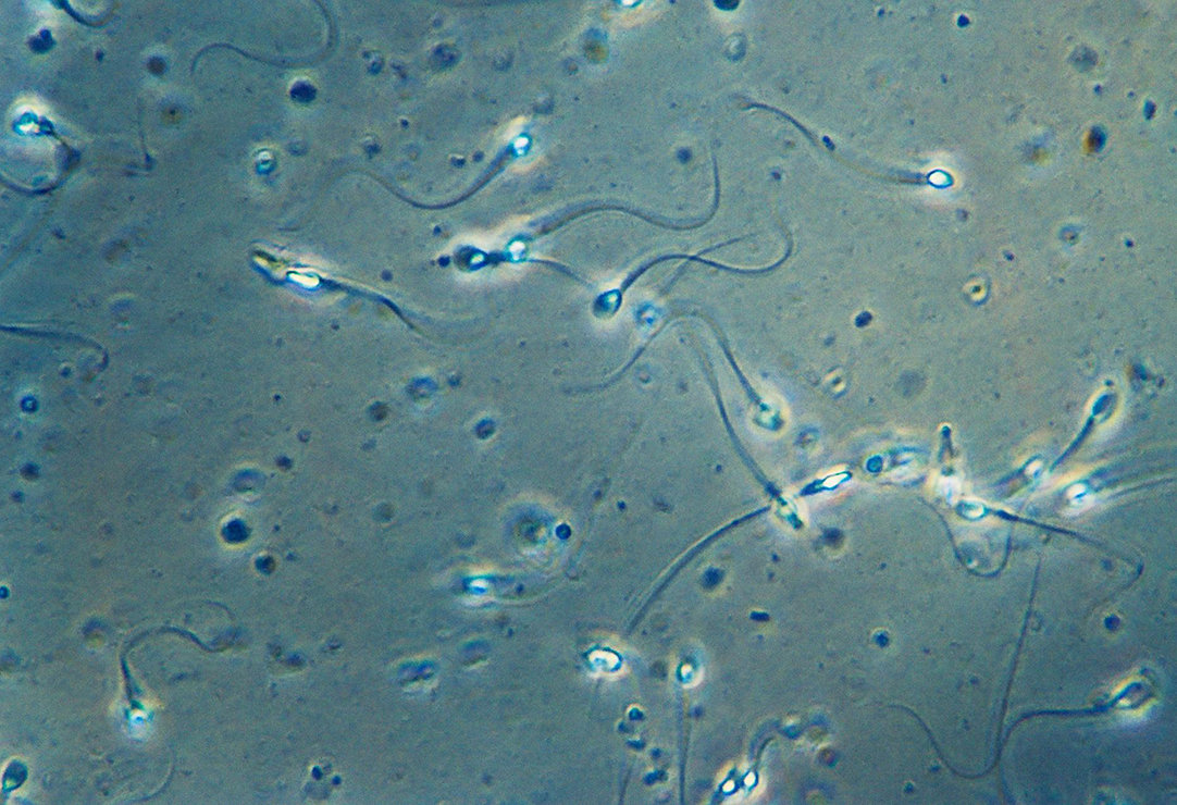 精子“骗了”科学家350年!研究发现:精子像钻头那样螺旋游动