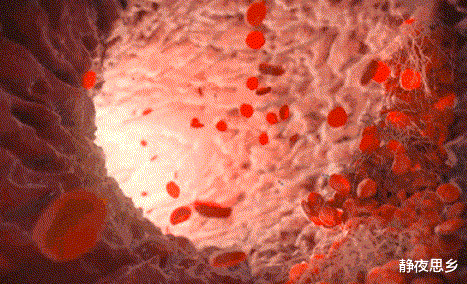 运动|人体竟然自带润滑液？这5种润滑液有什么用处？