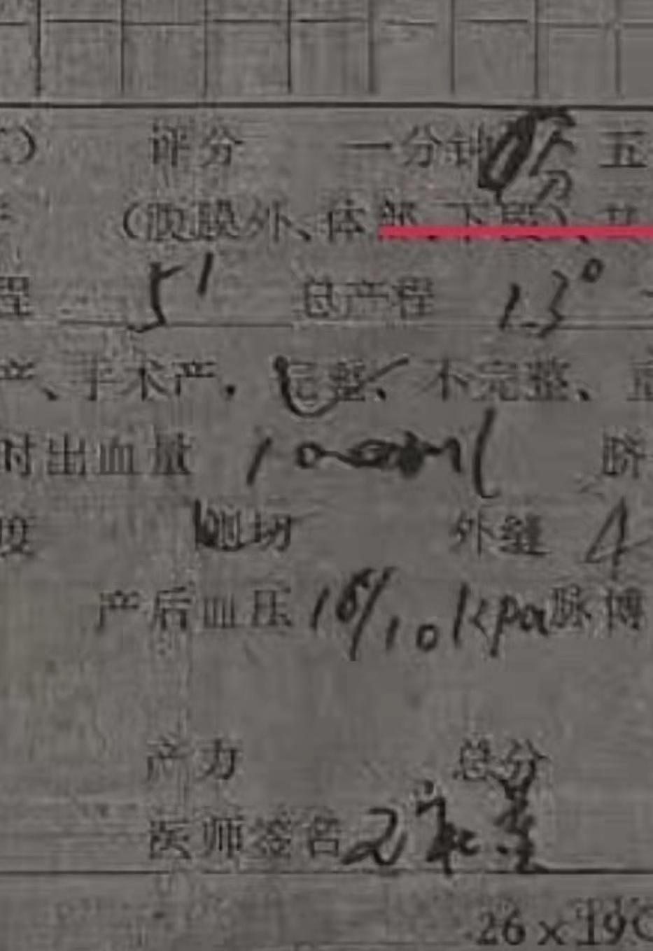 杜新枝自比张玉环,称可以拿国家赔偿,类比劳荣枝请律师辩护