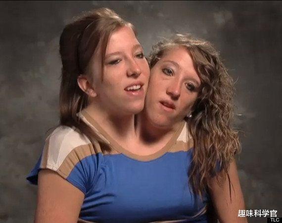 黑洞 “双头连体”姐妹花，如何控制同一个身躯？两个大脑更有优势吗？