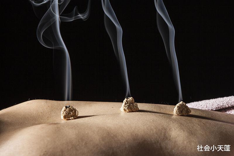 艾灸|冬季能艾灸吗？适合哪些人群？