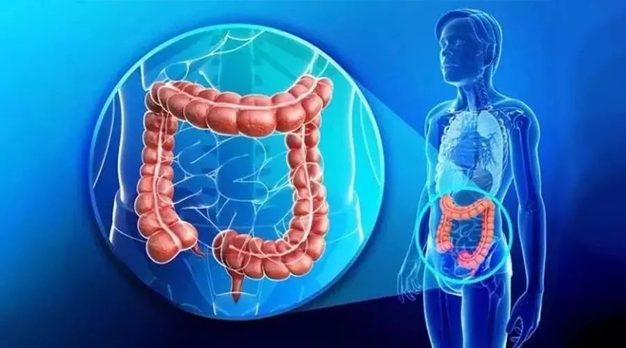 直肠癌|直肠癌多半是“拖”出来的！医生提醒：身体有2个感受，抓紧检查