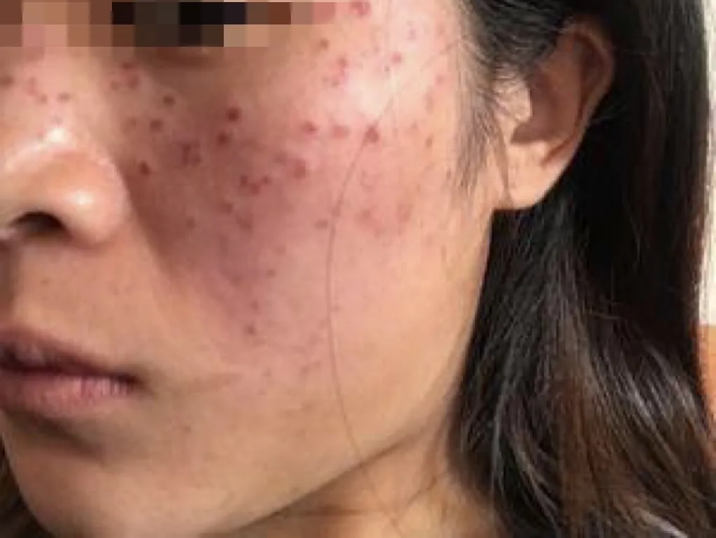 蛋糕裙 护肤指南｜原来这么多的问题归根结底都跟“皮肤微生态”有关！