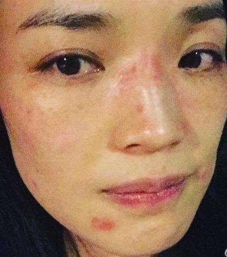 女明星生图,杨幂,热巴细纹盖不住,杨颖长痘,而最吓人的是她?