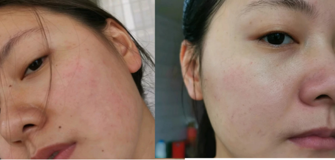 养生|哪些“冷门”又好用的孕妇护肤品？海蓝之谜上榜，家里空瓶堆成山