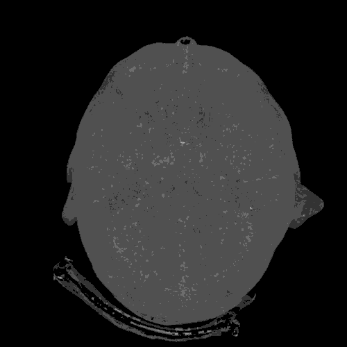  人体有多神奇？看完脑子一惊，生怕漏水