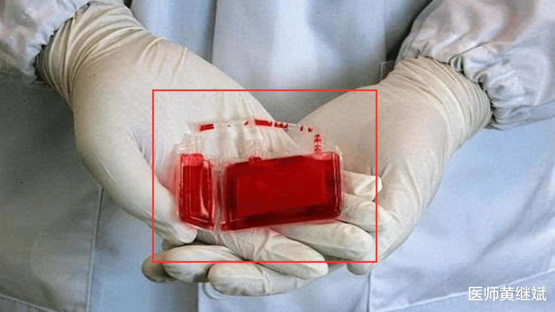 医师黄继斌|脐带血的事，读懂这篇你就懂了，建议读完再决定留还是捐