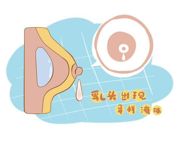 医说健康 乳腺癌发展时，身体会有4个典型症状，女性需重视，及时检查
