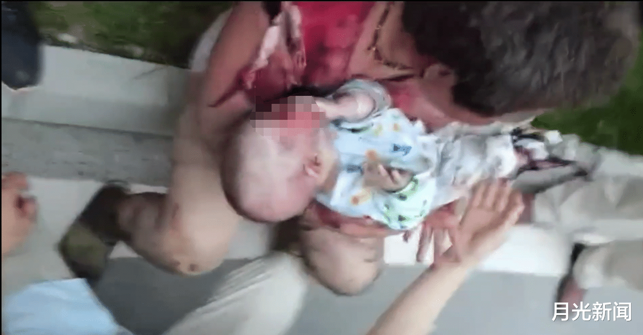 月光新聞 成都一電動車電梯內(nèi)自燃， 致6人受傷，五個月的嬰兒未脫離生命危險