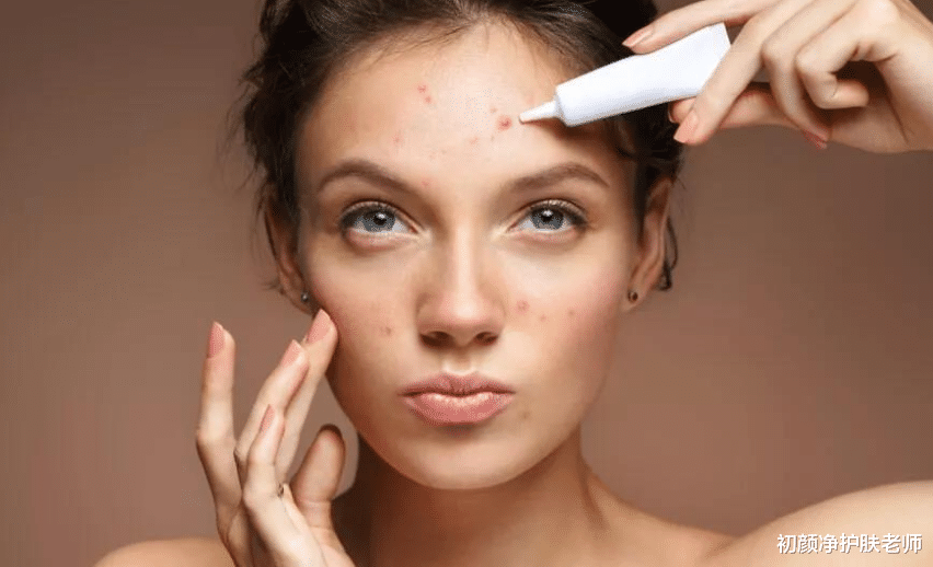 化妆品 为什么你一化妆就长痘？问题可能出在这些细节上！