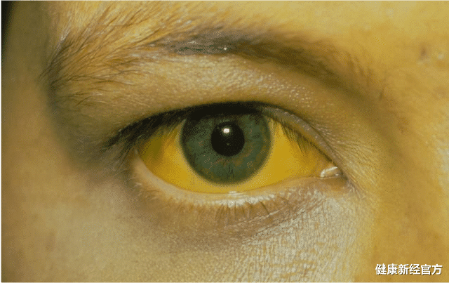 健康新经官方|男性晨起若有4种“异常”，肝或已悄悄变“硬”，一个不占，肝还“强壮”