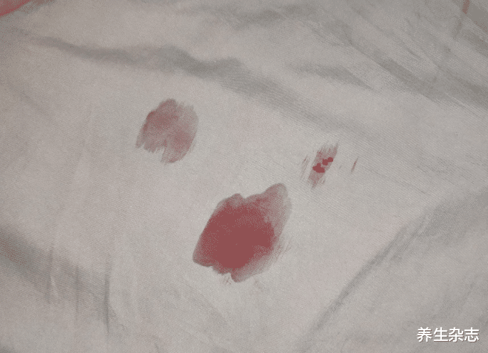 宫颈癌|女子身上有股臭味，查出宫颈癌，主任医师：明眼人一闻便知，别大意