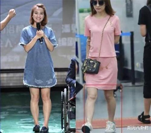 虞书欣|17位烦恼不一的女星，有人脱发秃顶治不好，有人反复发胖患抑郁