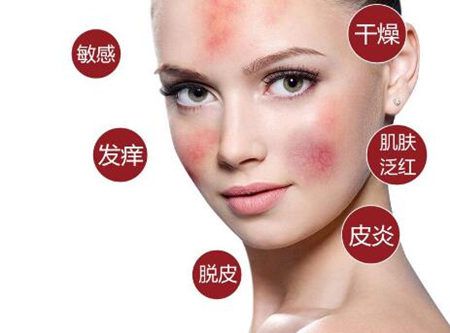 |脸干燥脱皮紧绷怎么应对？不想敏感，这四个雷区一定要避开！