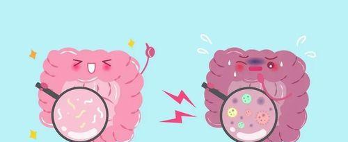 肠癌|26岁小伙查出肠癌晚期,原因令人心痛,医生:这种食物或是元凶