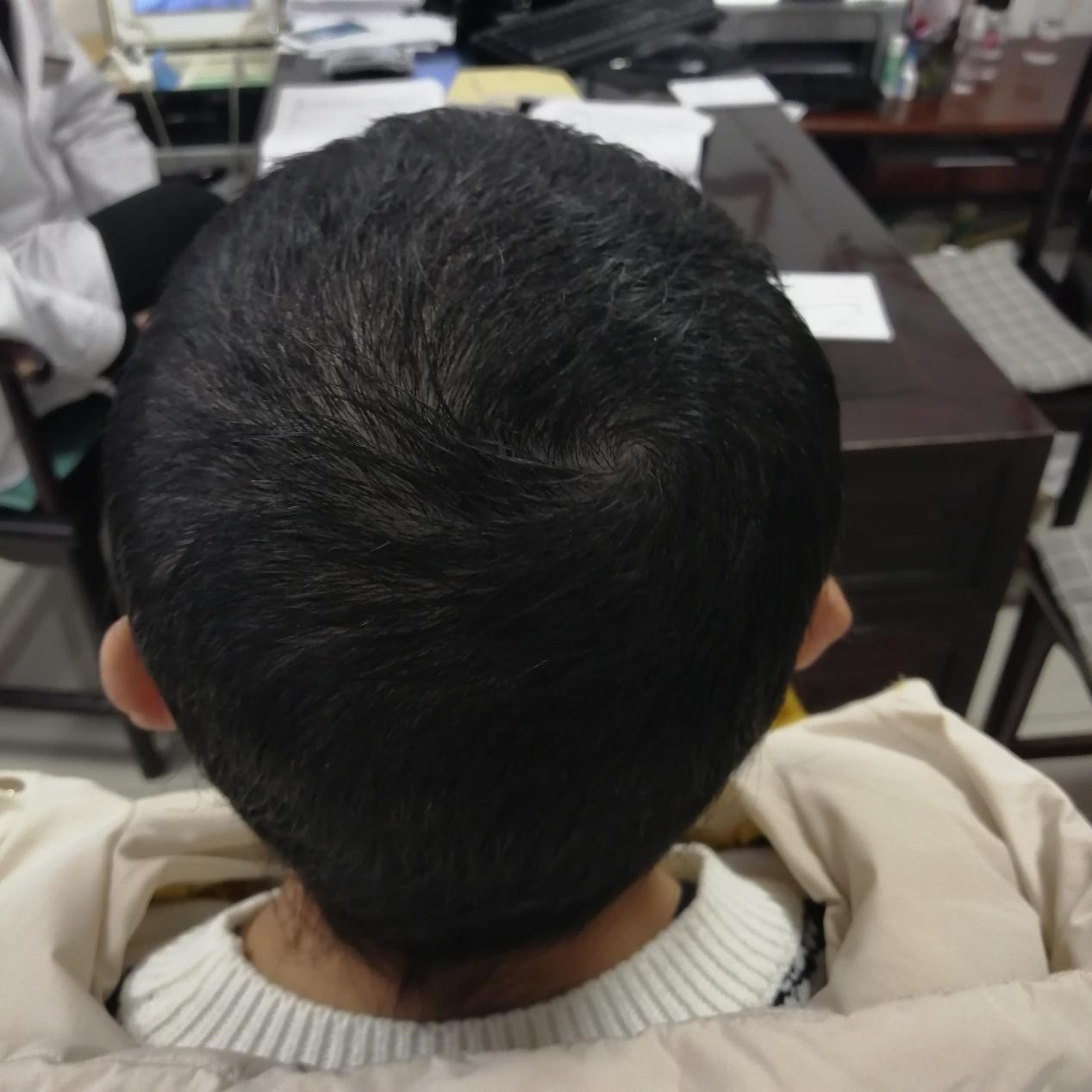 |养出好头发的食物有哪些