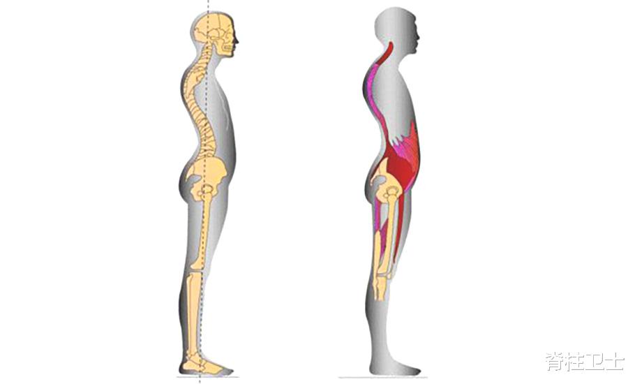 脑血管病|收藏|肋骨外翻如何有效矫正?