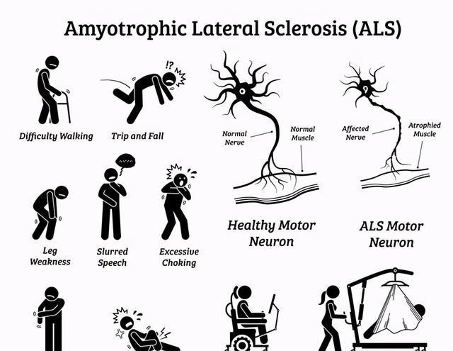 基因突变 医学、一夫一妻导致自然选择失效，人类进化停止？研究：正在加速