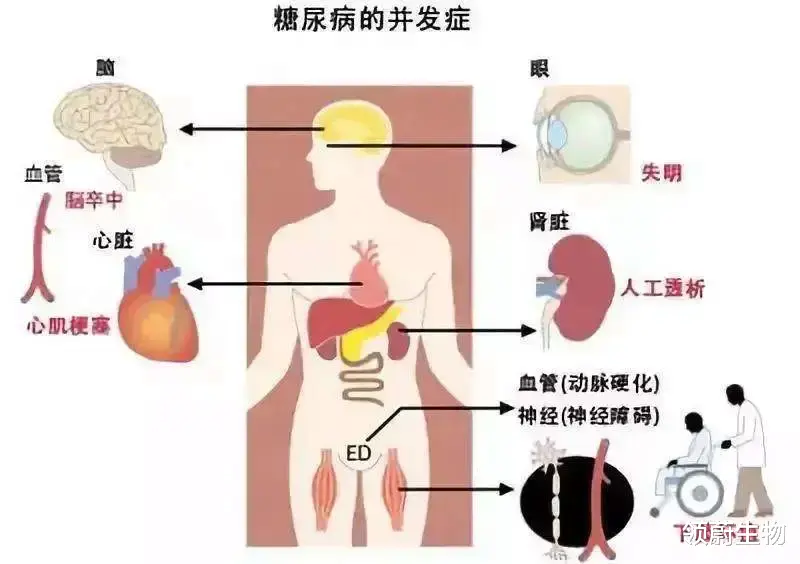 胃炎|間充質干細胞可增強糖尿病患者傷口愈合能力, 加速傷口愈合