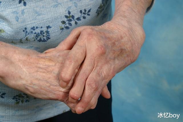 尿酸|真正的嘌呤“大王”被揪出，海鲜都“自愧不如”，想要降尿酸，餐桌上赶紧撤下