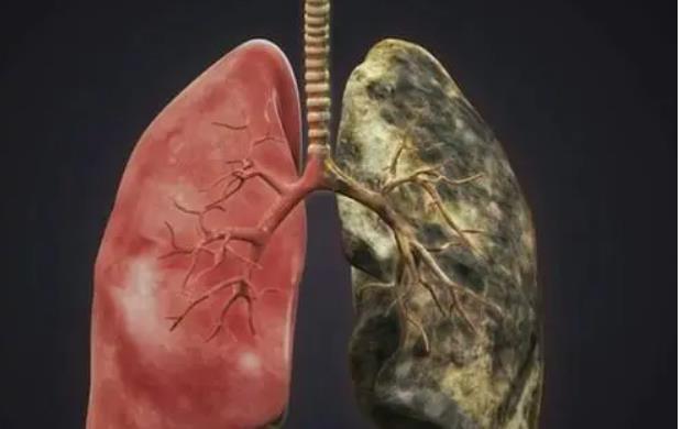 蔬菜|吸烟者晨起有4个“异常”，肺或已经变黑，一个不占，肺或还洁净