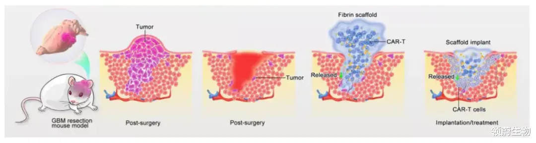 太空 恶性脑瘤迎来新CAR-T疗法！64%小鼠治疗后94天肿瘤无复发！
