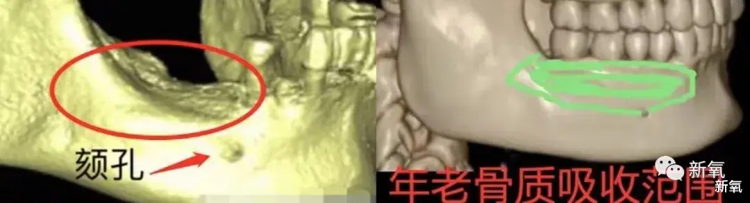 蔡少芬|孙俪之后，为什么蔡少芬身上的美人感也逐渐消失了？