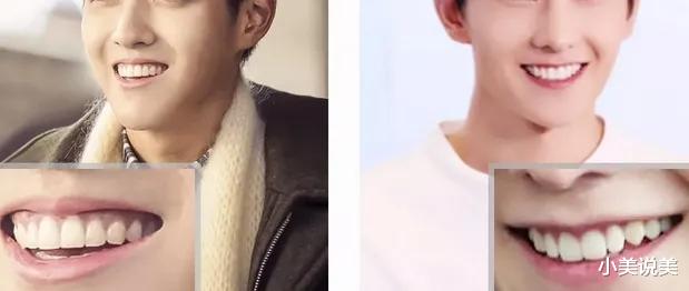 小美说美 笑，没有感染力？离不开这几个原因