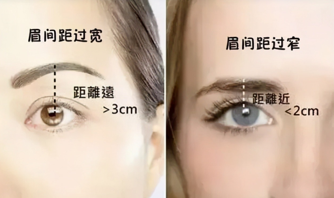 史迎军眼整形|史迎军眼整形 | 什么样的眼睛才是美的？