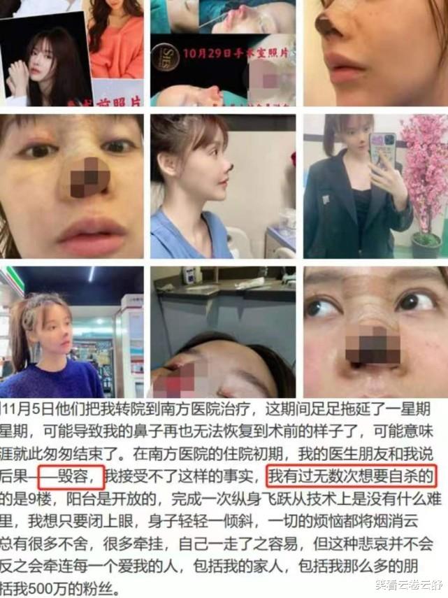 金晨|那些乱整鼻子的明星还好么?有人变成真人马里奥,有人像金角大王