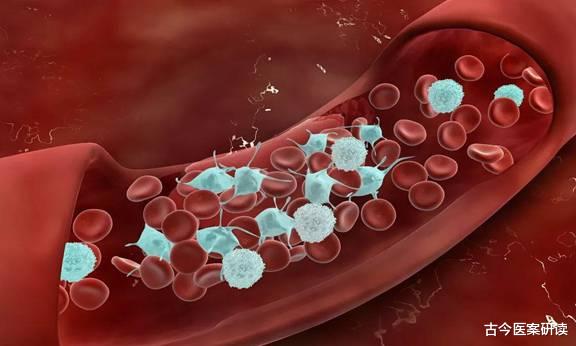 古今医案研读|血液“稀释剂”被找到，不是柠檬水，你若爱吃，远离脑梗，血管一通到底