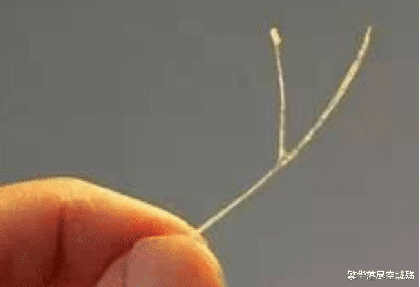 鱼刺卡在喉咙,不要再喝醋了,教你简单方法,鱼刺自动跑出来