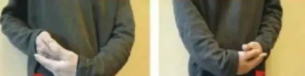 |刘来发老师：请收藏，神阙穴正确完整的揉法