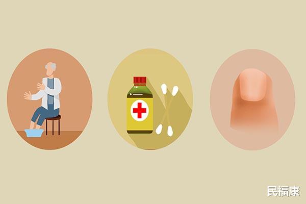甲沟炎|脚指甲长到肉里面，一走路就疼？自己在家如何应对？