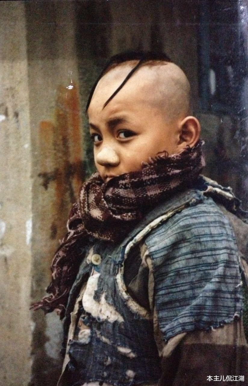 孟智超|8岁成名，14岁秃顶，植发挨300多针不后悔，还记得“三毛”孟启超吗
