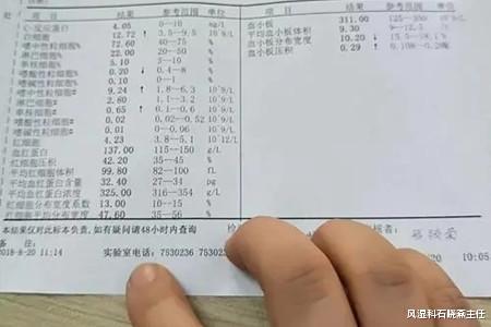 风湿科石晓燕主任|类风湿因子高出参考值，到底意味着什么？