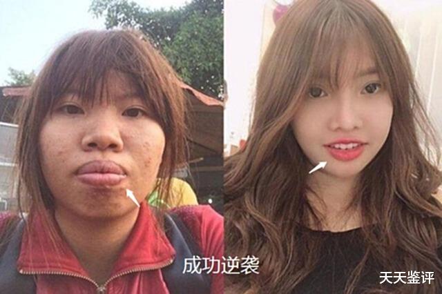 女子整容成功嫁给富二代,孕期突然“现原形”,怕老公嫌弃而大哭
