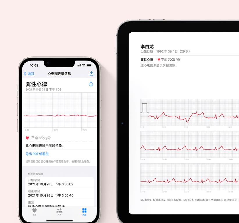|苹果正式官宣，Apple Wacth国行版移动心电图房颤提示软件上线！
